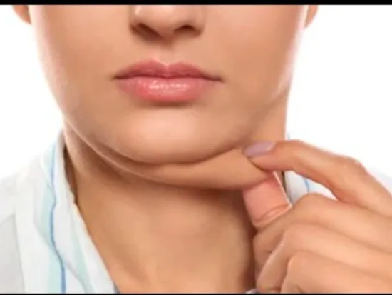 Papada feminina, incomoda milhares de mulheres